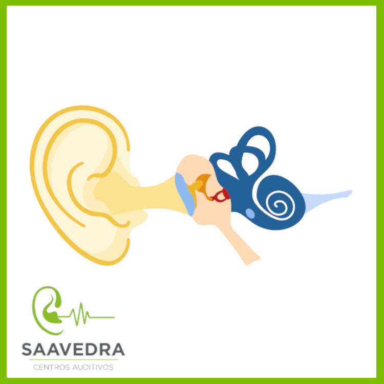 Clases de pérdida de audición