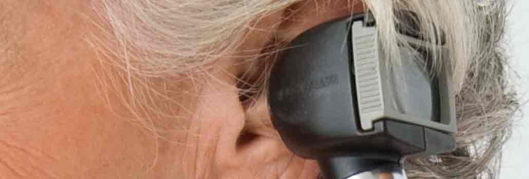 Clases de pérdida de audición